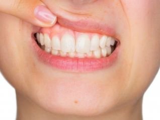 Você conhece as aplicações da Ozonioterapia da periodontia e na implantodontia?