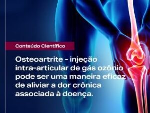 tb artigo cientifico ozonioterapia em osteoartrite do joelho 55 5413 Philozon | Geradores de Ozônio