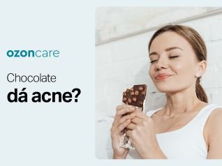 Chocolate dá acne?