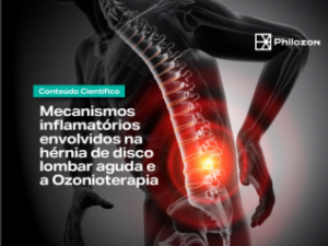 Mecanismos inflamatórios na hérnia de disco lombar aguda e Ozonioterapia