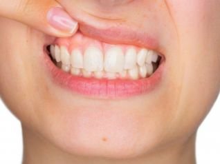 tb voce conhece as aplicacoes da ozonioterapia da periodontia e na implantodontia 40 7356 Philozon | Geradores de Ozônio