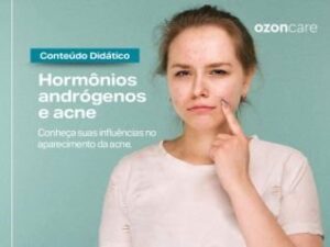 Hormônios andrógenos podem influenciar no aparecimento da acne?