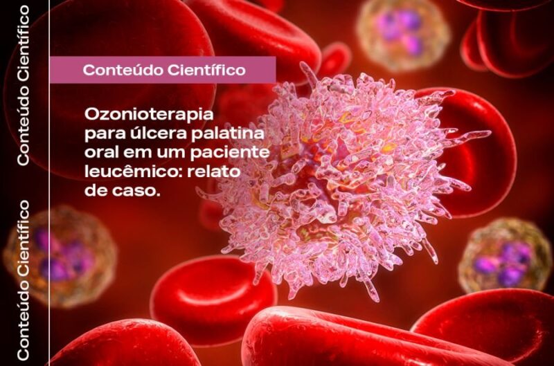 Ozonioterapia e trato de úlcera palatina