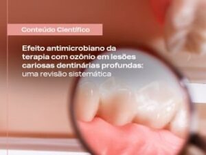 Ozônio em lesões cariosas dentinárias profundas