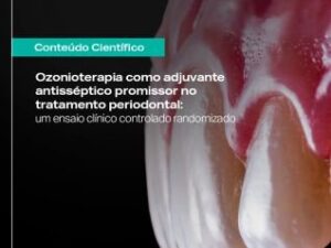 Ozonioterapia como adjuvante antisséptico promissor do tratamento periodontal