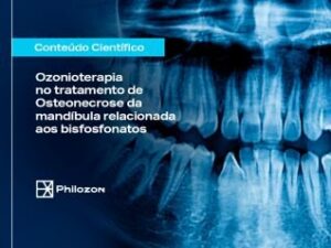 Ozonioterapia no tratamento de Osteonecrose da mandíbula relacionada aos bisfosfonatos