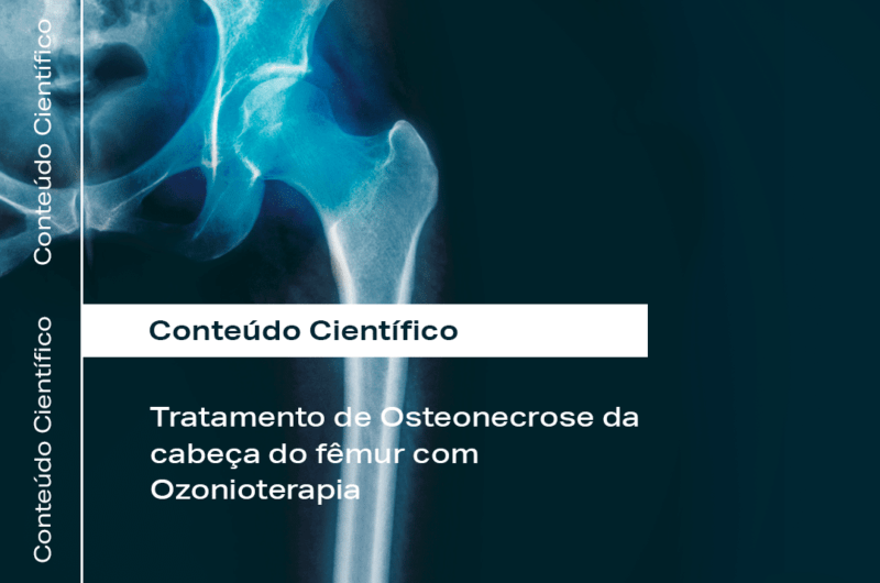 Tratamento de Osteonecrose da cabeça do fêmur com Ozonioterapia