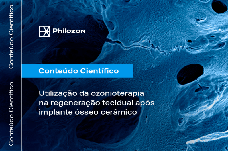 ozonioterapia na regeneração tecidual