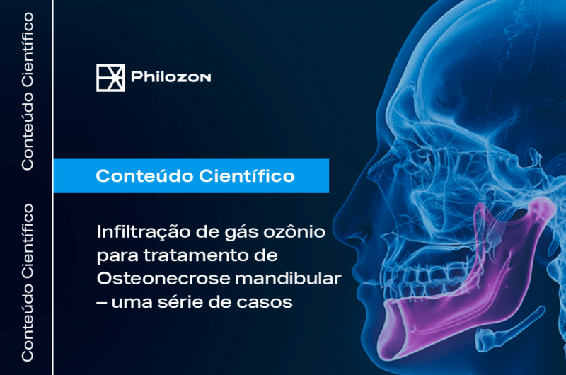 Infiltração de gás ozônio para tratamento de Osteonecrose mandibular