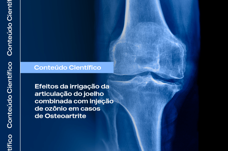 Ozonioterapia no tratamento de Osteoartrite do joelho