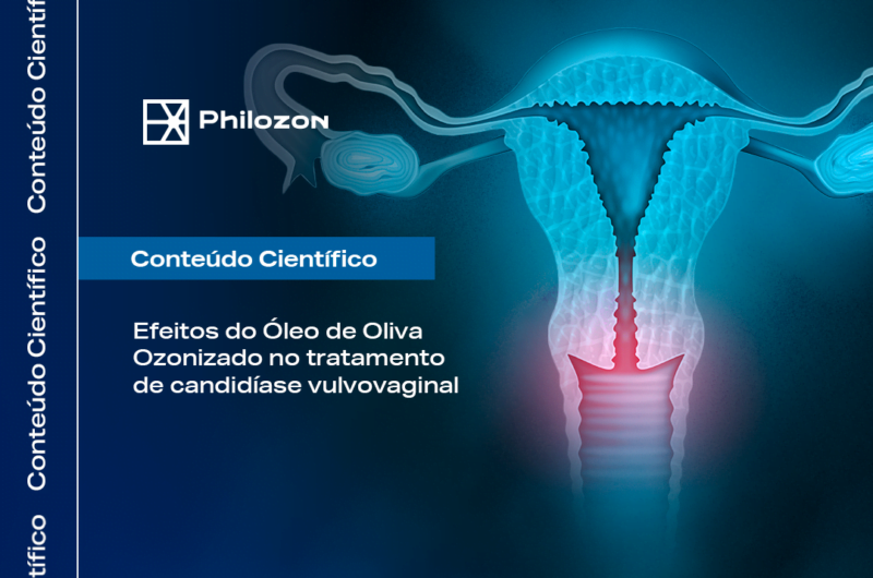 Efeitos do Oleo de Oliva Ozonizado no tratamento de candidiase Philozon | Geradores de Ozônio