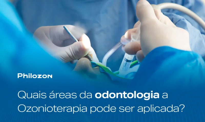 Quais areas da Odontologia a Ozonioterapia pode ser aplicada Philozon | Geradores de Ozônio