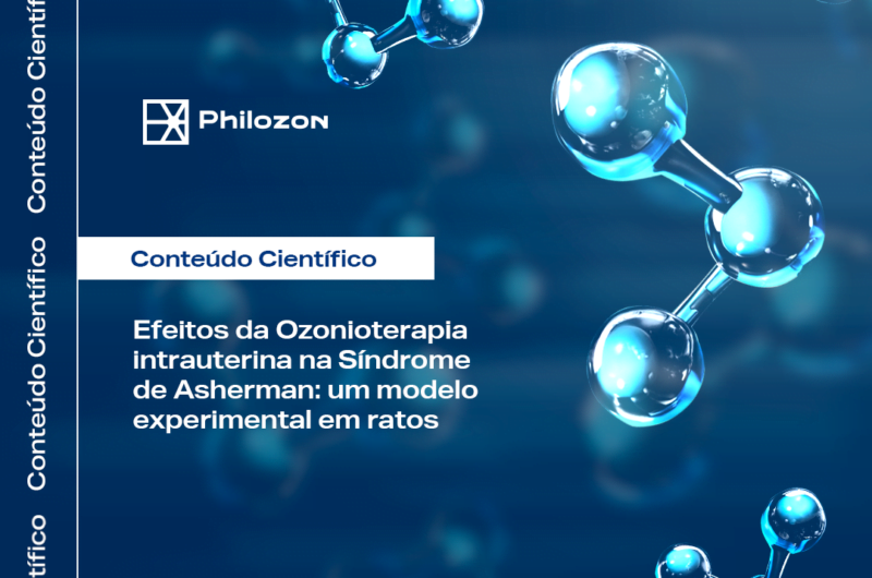 Efeitos da Ozonioterapia intrauterina na Sindrome de Asherman Philozon | Geradores de Ozônio