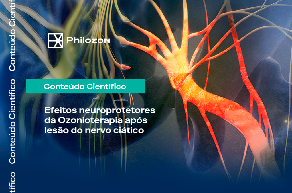 Efeitos neuroprotetores da Ozonioterapia apos lesao do nervo ciatico Philozon | Geradores de Ozônio