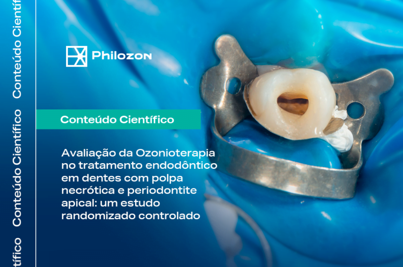 Ozonioterapia no tratamento endodontico em dentes com polpa necrotica e periodontite apical Philozon | Geradores de Ozônio