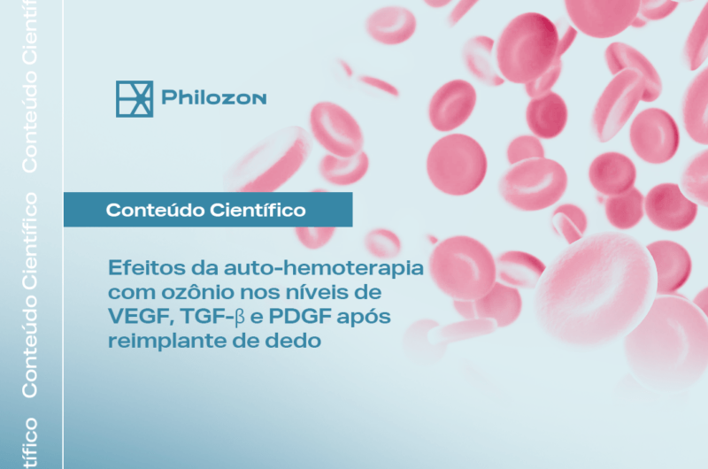 Efeitos da auto hemoterapia com ozonio nos niveis de VEGF TGFβ e PDGF apos reimplante de dedo Philozon | Geradores de Ozônio