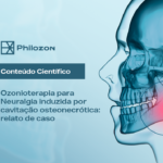 Ozonioterapia para Neuralgia Induzida por cavitação osteonecrótica