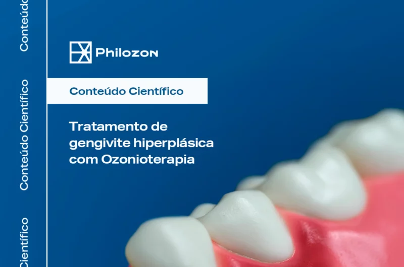 Tratamento de gengivite hiperplasica com Ozonioterapia Philozon | Geradores de Ozônio