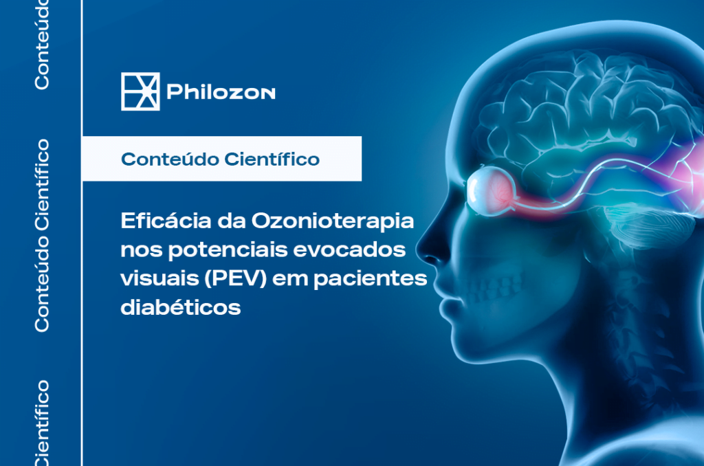 Eficacia da Ozonioterapia nos potenciais evocados visuais PEV em pacientes diabeticos Philozon | Geradores de Ozônio