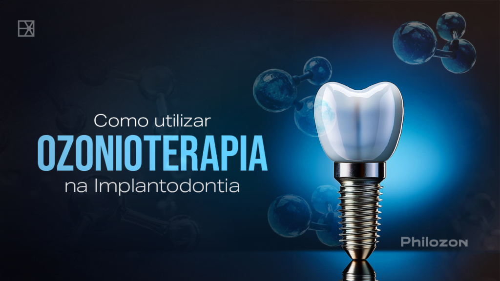 CAPA BLOG COMO UTILIZAR OZONIO IMPLANTODONTIA Philozon | Geradores de Ozônio