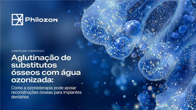Copia de Verao e resposta inflamatoria na estetica 1024 x 576 Philozon | Geradores de Ozônio