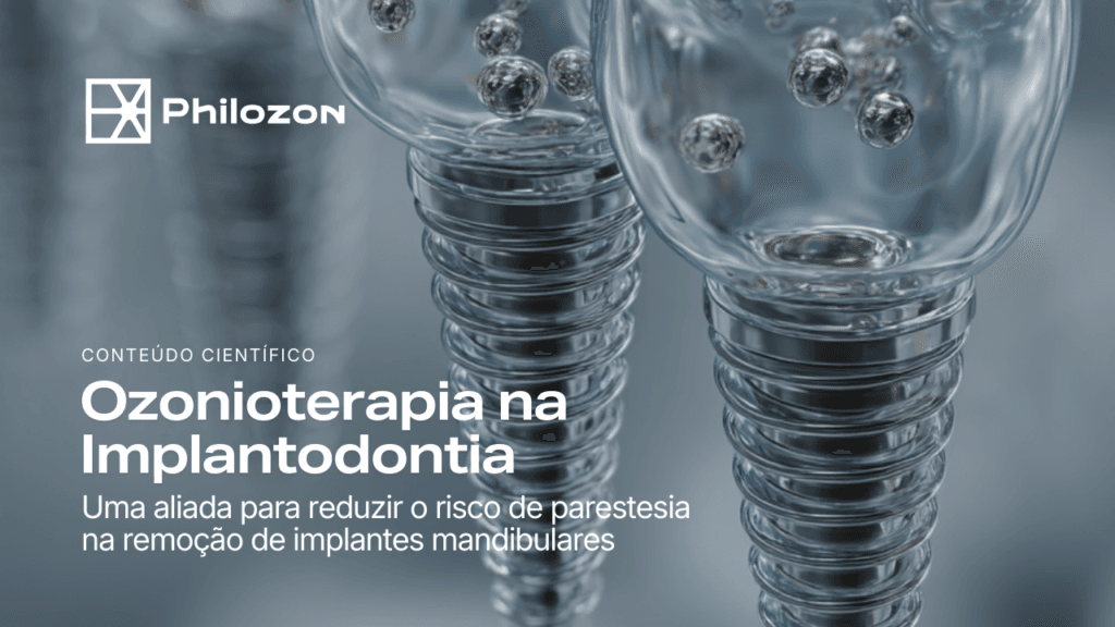 Ozonioterapia como estratégia complementar para reduzir o risco de parestesia na remoção de implantes mandibulares 1 Philozon | Geradores de Ozônio Implantodontia Philozon | Geradores de Ozônio