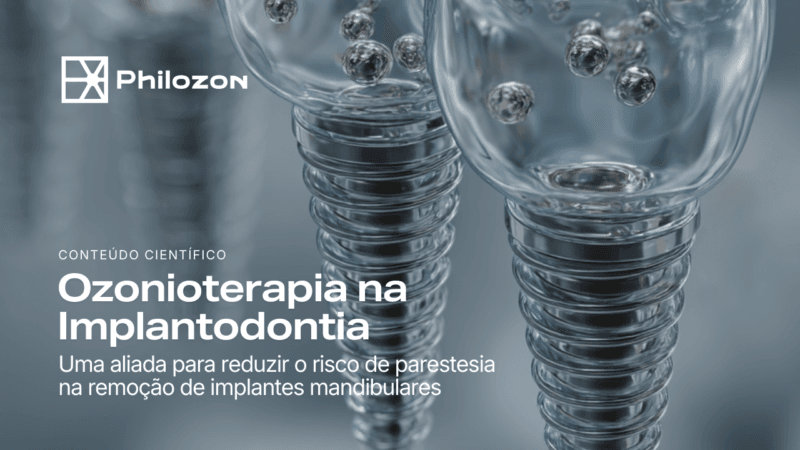Implantodontia Philozon | Geradores de Ozônio