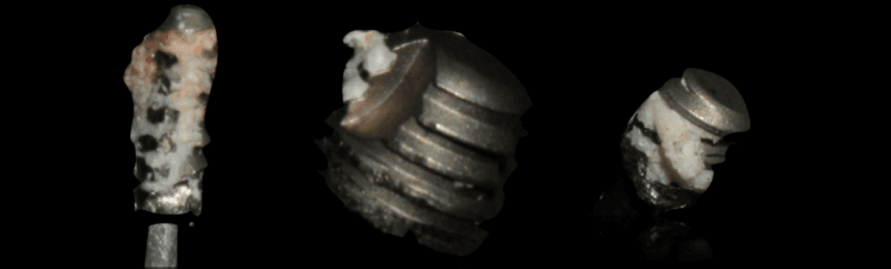 Ozonioterapia como estratégia complementar para reduzir o risco de parestesia na remoção de implantes mandibulares 3 Philozon | Geradores de Ozônio artigo1 Philozon | Geradores de Ozônio