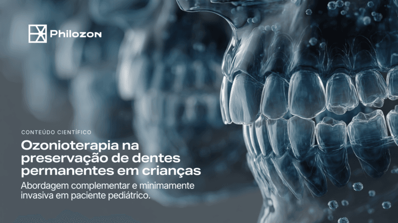 imagem destacada ozonioterapia na preservacao de dentes Philozon | Geradores de Ozônio